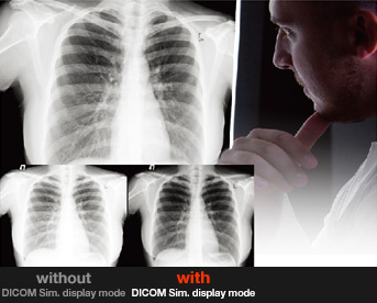 chế độ hiển thị DICOM Sim ứng dụng giảng dậy y học